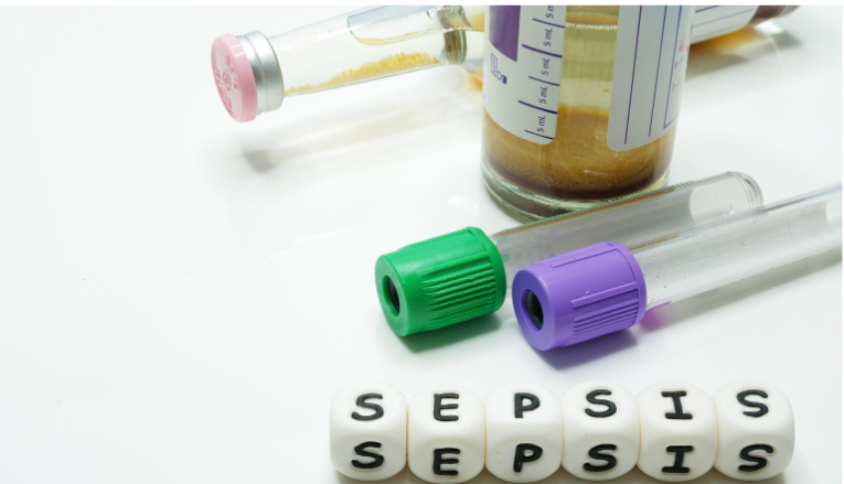 Test tubes, medicine bottles and the word Sepsis spelled out in cubes